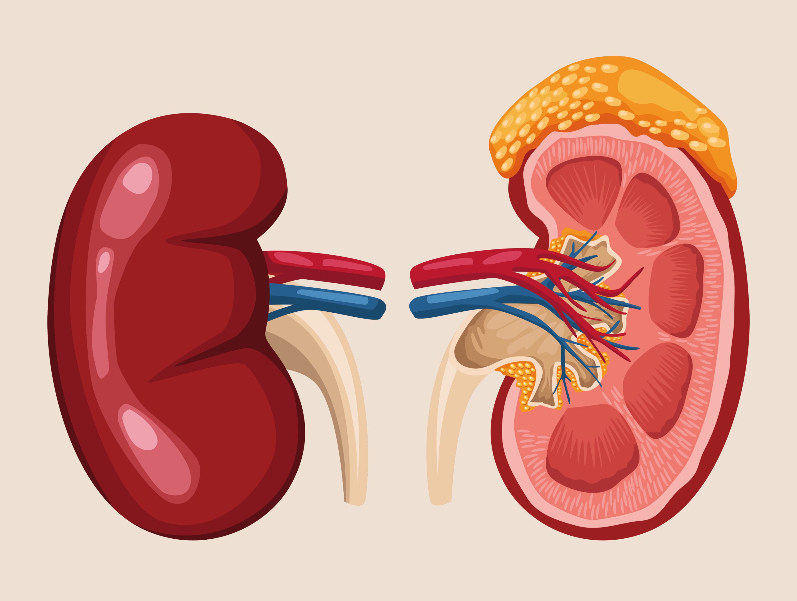 Kidney transplantation consultation with Dr. Suhas Mondhe"