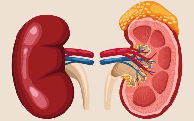 Kidney transplantation consultation with Dr. Suhas Mondhe"