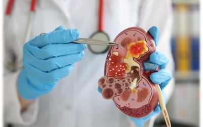 Dr. Suhas Mondhe performing a kidney biopsy on a patient.