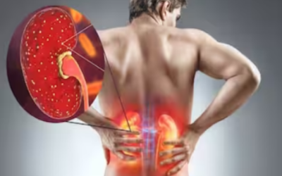 Chronic kidney failure treatment with Dr. Suhas Mondhe